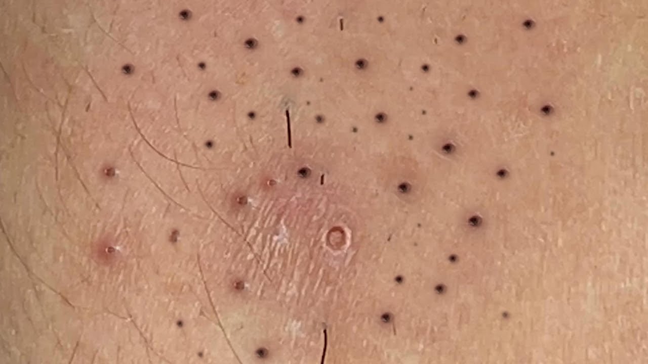 Satisfying Relaxing with Sac Dep Spa Video (#147)