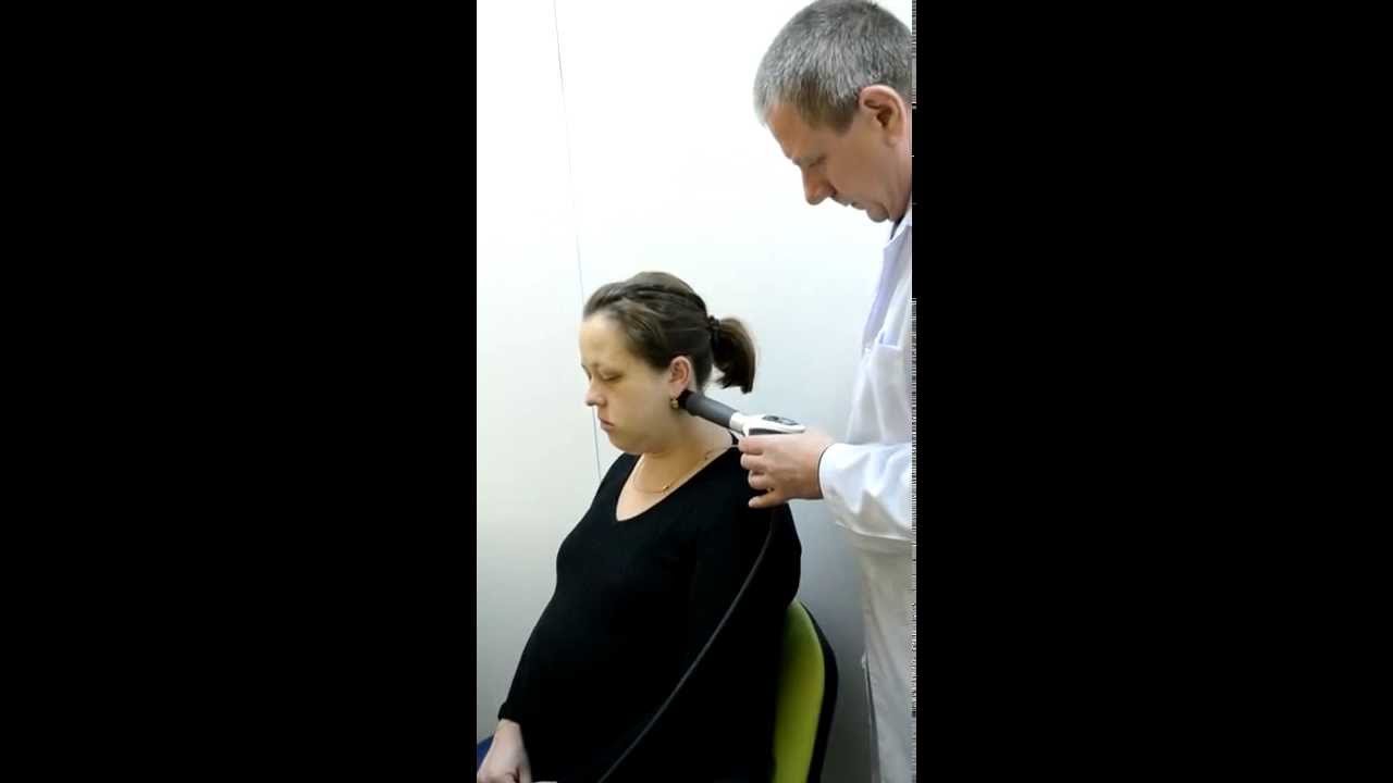 Неврит лицевого нерва. Лечение ударно-волновой терапией