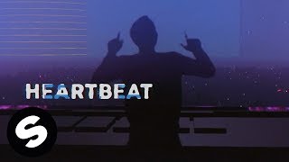 Video thumbnail of "Dastic x Robbie Mendez - Heartbeat (Official Lyric Video)"