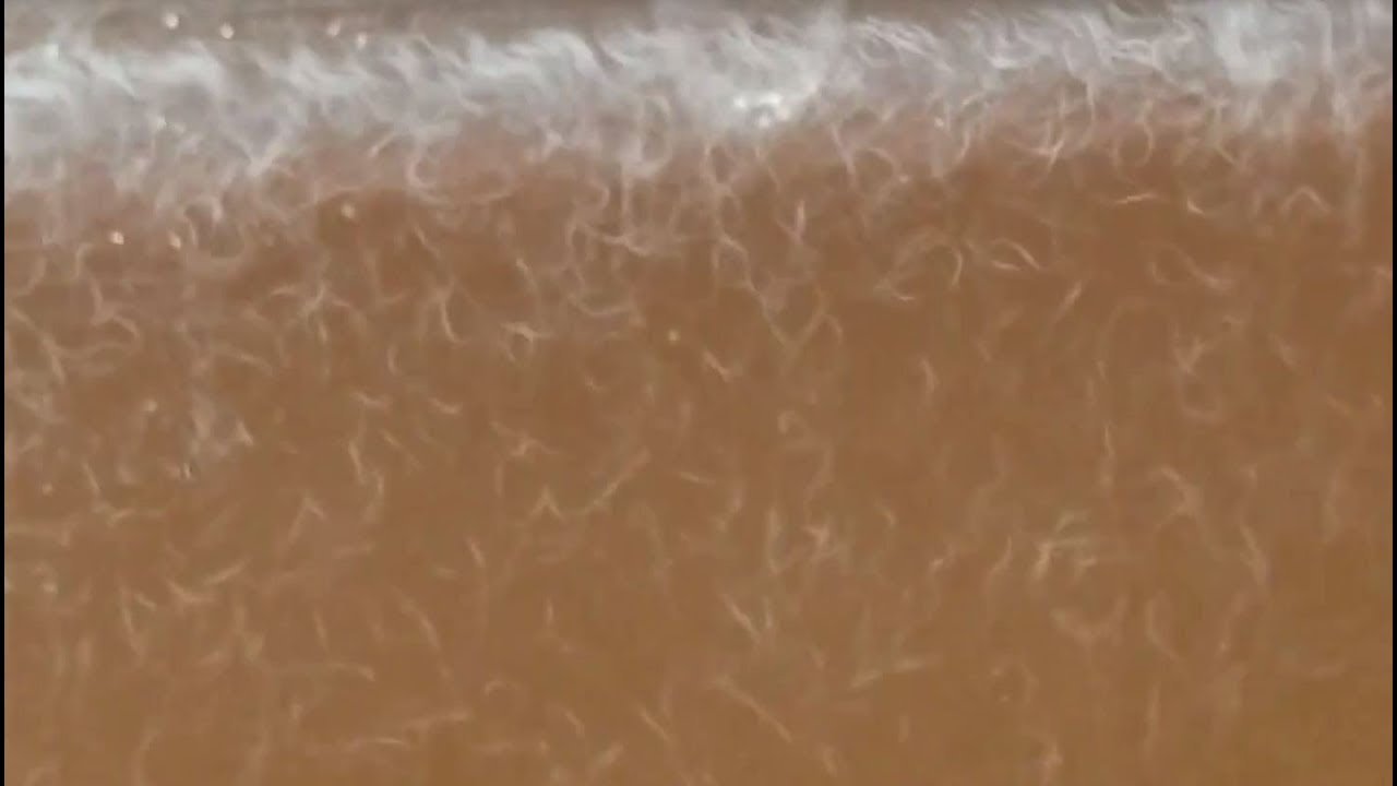 Do you know about Vinegar Eels? Turbatrix Aceti YouTube