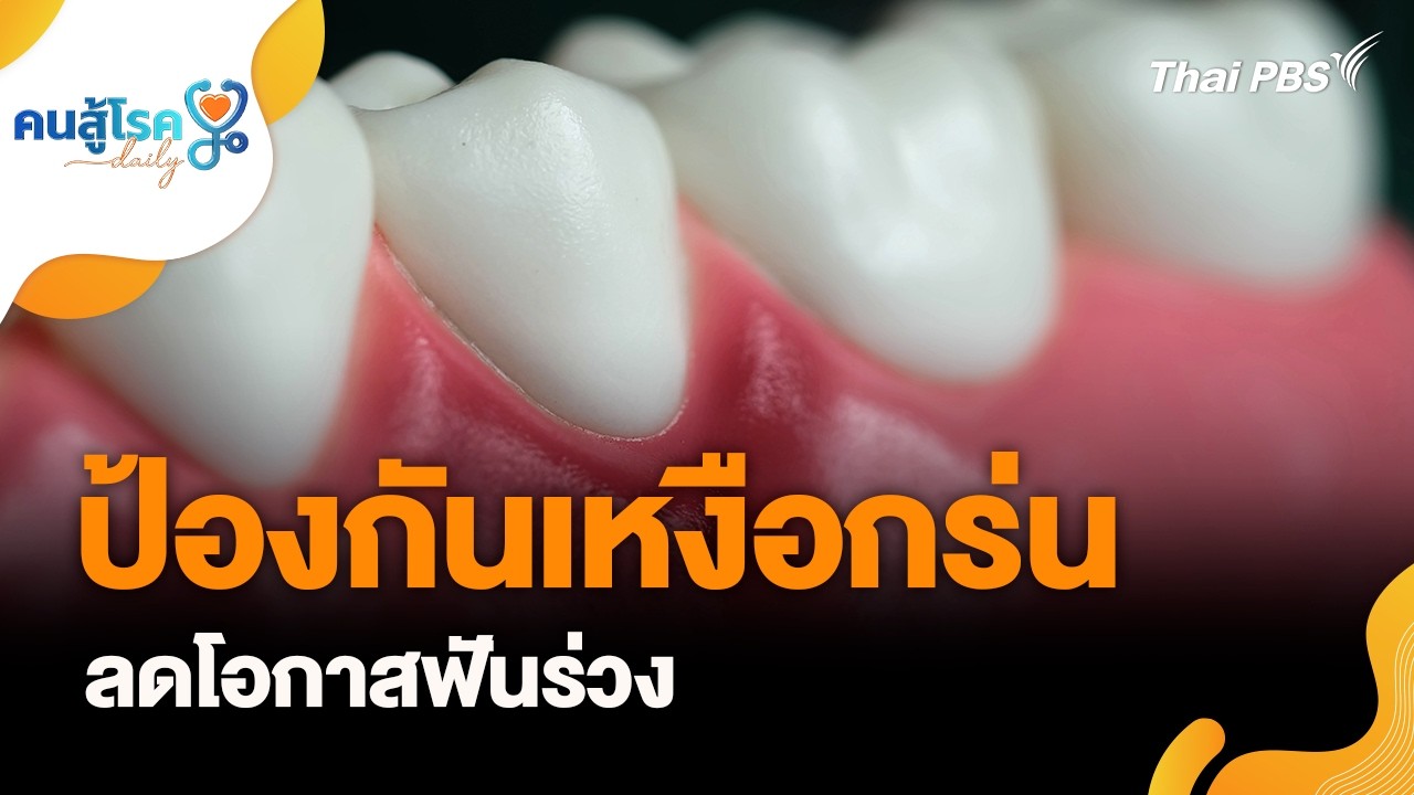 ป้องกันเหงือกร่น ลดโอกาสฟันร่วง | คนสู้โรค Daily | 10 มี.ค. 69