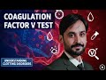 Coagulation Factor V Test | Factor 5 Deficiency Test | Factor V Explained | Factor V Normal Range