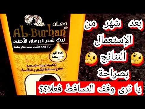 Al Burhan Yellow Oil For Hair Loss Original Did It Stop The Hair Loss My Experience