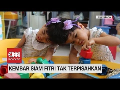 Video: Kembar Siam Terpisah Yang Lahir Dengan Kepala Menyatu, Dua Bulan Setelah Operasi - Pandangan Alternatif
