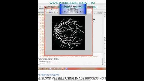 ANALYSIS OF RETINAL BLOOD VESSELS USING IMAGE PROCESSING TECHNIQUES -MATLAB ASSIGNMENTS PROJECTS
