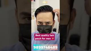 Best Quality Hair Patch for Men | Permanent Hair Patch Delhi | Hair Wigs for Mens #wigs #hairpatch