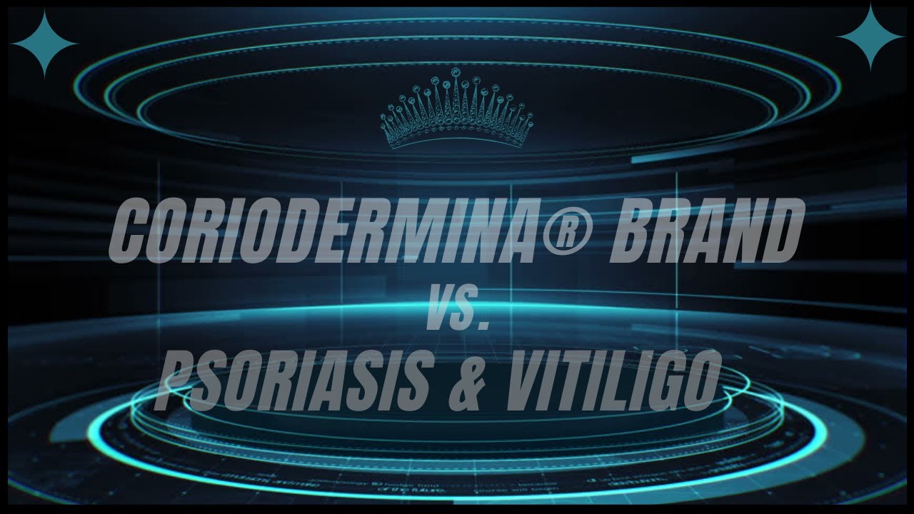 CORIODERMINA BRAND®: VS. Psoriasis and Vitiligo - One Way to Save the Cost of Psoriasis Treatment.
