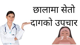 Chhalama Seto Daag or Putlako Gharelu Upachar || Skin White Spot Treatment at Home screenshot 5