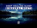 Deep Sleep Healing Music: Binaural Beats for Sleep Healing, Insomnia Relief