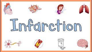 Infarction : Causes, Types, Morphology & Factors influencing development of infarction