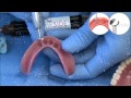 Clinical Demonstration: Zest CHAIRSIDE® Denture Prep & Polish Kit