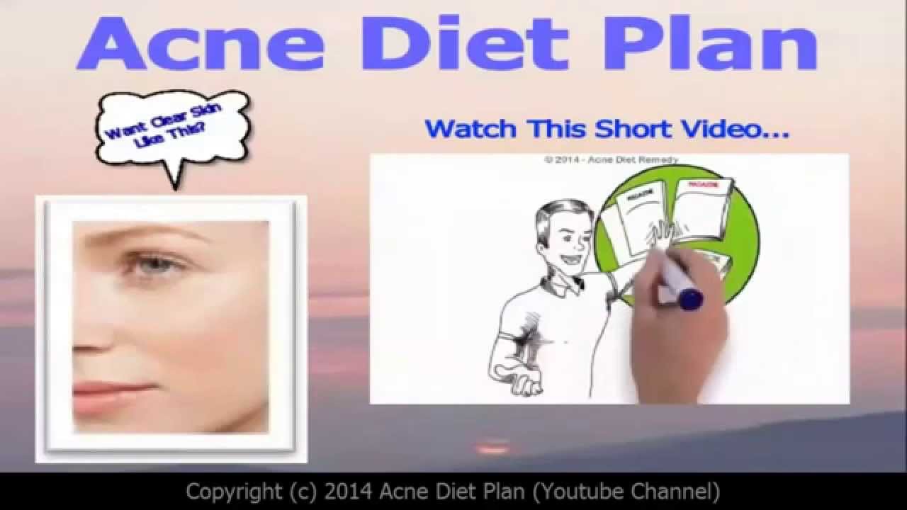 Pimple Diet Chart