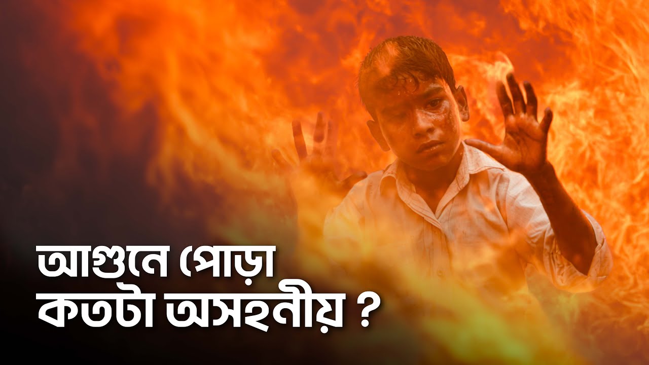 বিমান দুর্ঘটনার আগুনে পুড়ে যাওয়া কতটা অসহনীয় ?