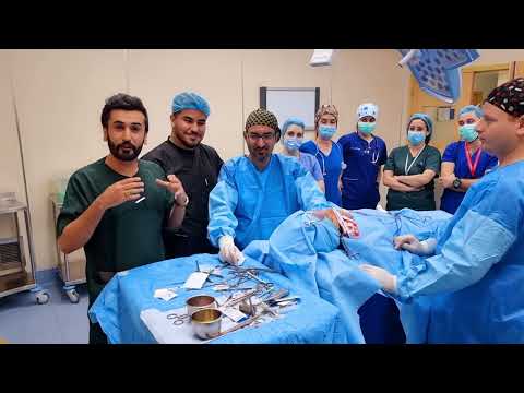دكتور الايراني المشهور علي اكبر صادقي في بغداد يسوي عمليات تجميل الانف