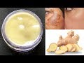 DIY Ginger Cream | Remove Pigmentation, Dark Spots & Acne Scars| Anti-Aging & Skin Lightening Cream