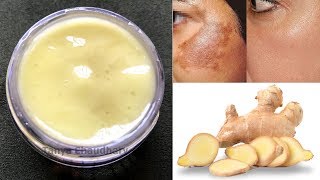 DIY Ginger Cream | Remove Pigmentation, Dark Spots & Acne Scars| Anti-Aging & Skin Lightening Cream