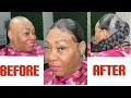 She wanted to try this frontal 5 strand braid/Alopecia transformation