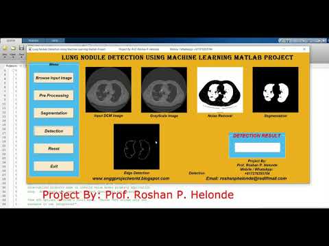 Lung Nodule Detection On Dicom Image Using Machine Learning | With Source Code | Python Project Code