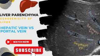 liver parenchyma echo texture portal and hepatic vein Meaning Of Echogenicity Of Liver