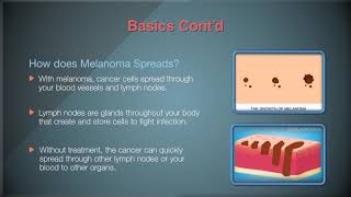 Advanced Melanoma Part 1