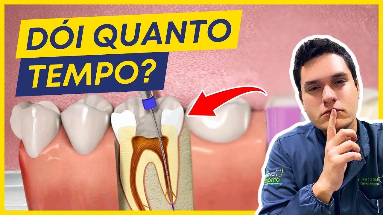 QUANTOS DIAS O DENTE DÓI DEPOIS DE TRATAR O CANAL? - YouTube