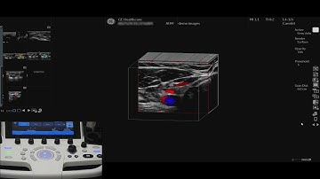 LOGIQ P9 Tutorials: 3D Capabilities