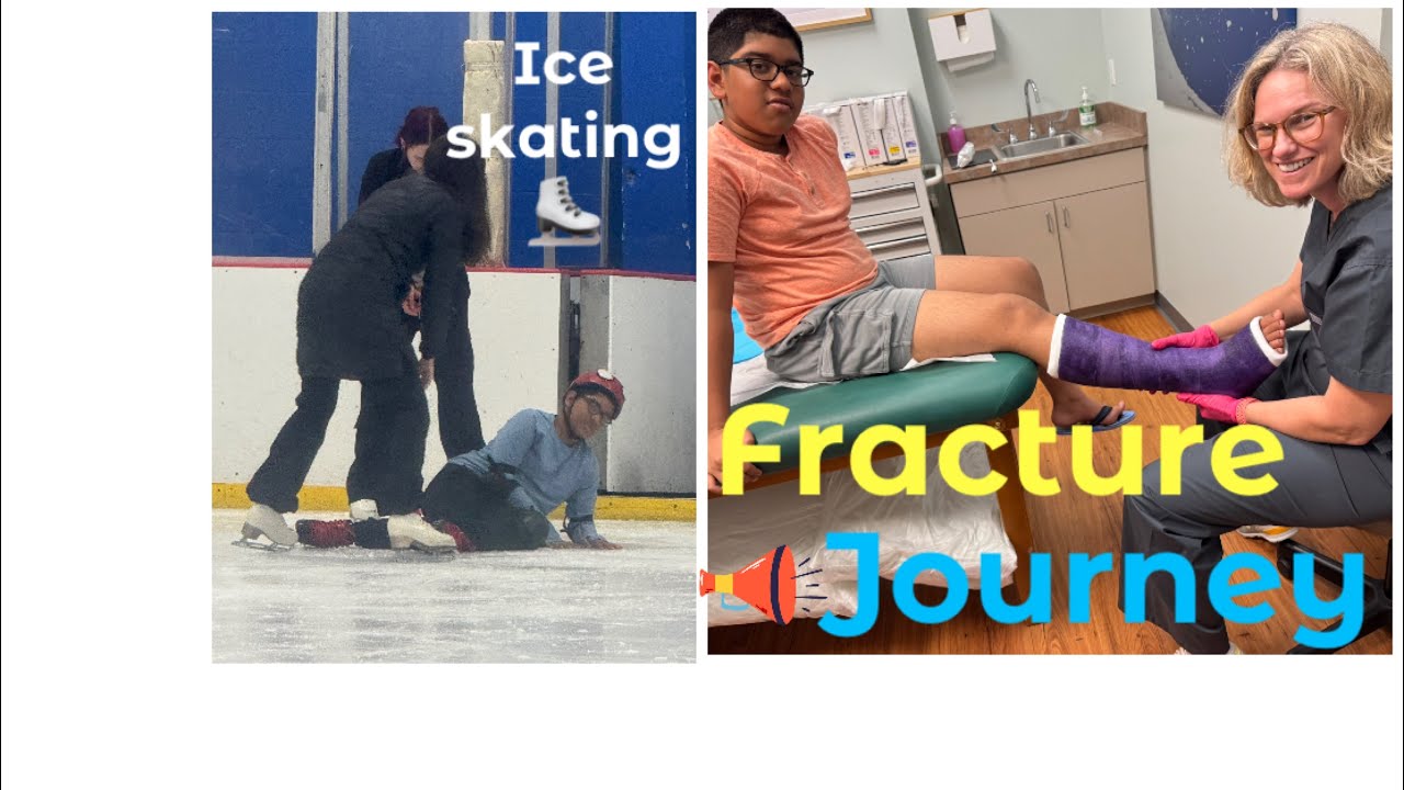 Ice skating ⛸️ # 🦵🏻fractured leg# 3 months 🙃# recovery # back to normal🥳 # Hooray😎 