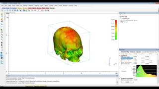 Tutorial: Mimics Innovation Suite - Model Thickness Analysis