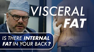 Visceral Fat - Is There Internal Fat in the Back?