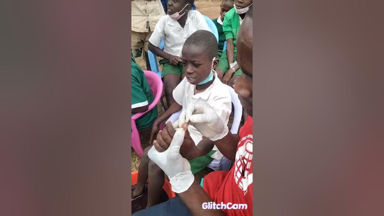 JIGGERS JIGGERS TREATMENT BY PST MOSES WALUBENGO BUNGOMA YouTube