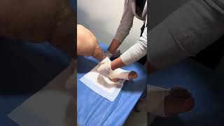 Consecuencias de vendajes equivocados en linfedema