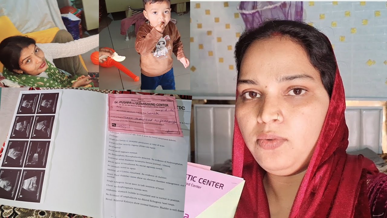 Level 2 Ultrasound जुड़वा बच्चों का सच सुन लो 🤔 #Pregnancy #video #ritu #vlog#viral #love#viralvideo