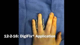 Traumatic Pip Flexion Contracture