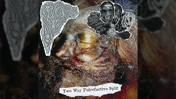 Two Way Putrefactive Split (Split w/ Hemorrhagic Necrotizing Entercolitis) FULL SPLIT