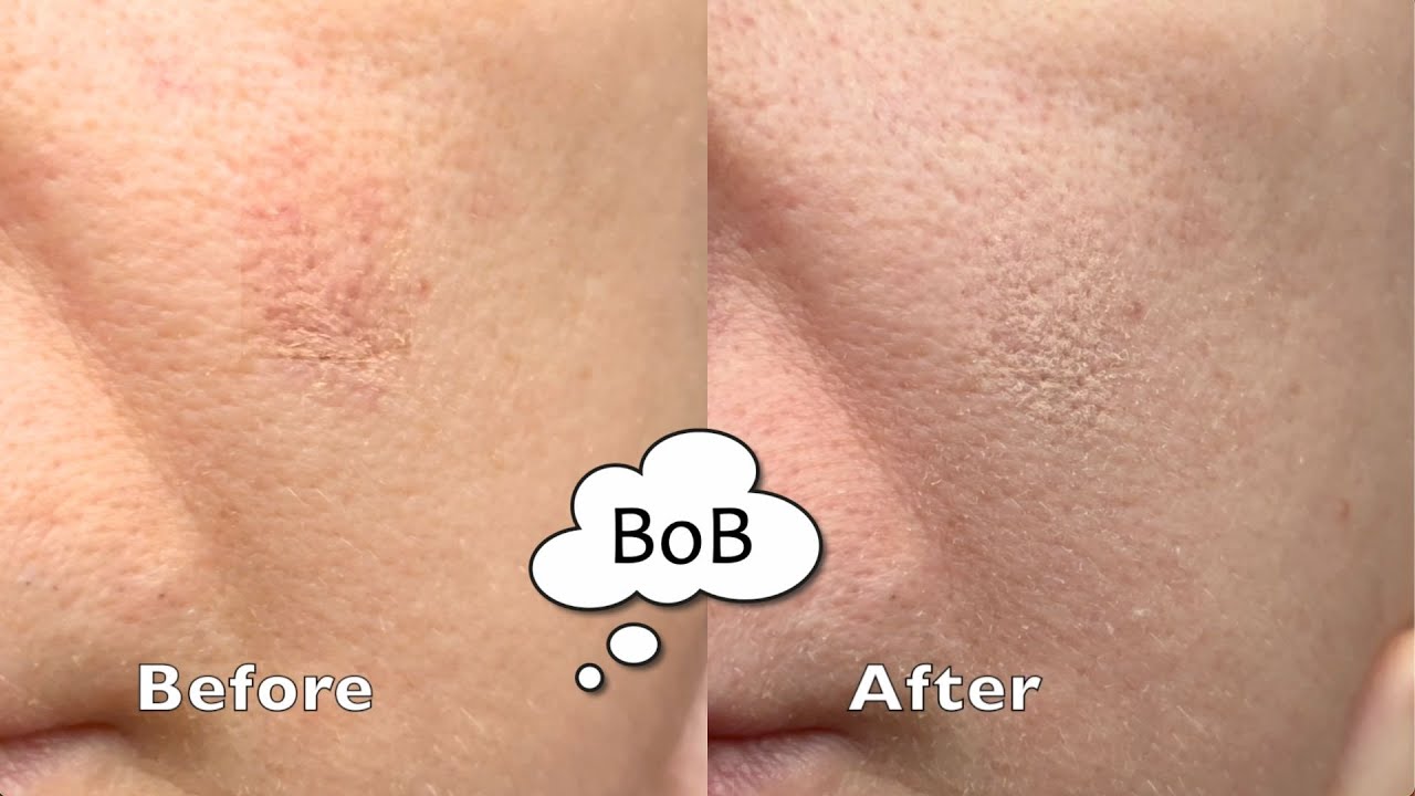 A Lifesaver for Marked Skin! LISA ELDRIDGE Pinpoint Concealer Micro Correcting Pencil