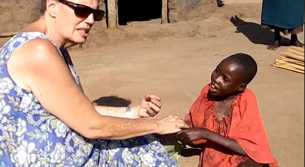 NODDING DISEASE IN NORTHERN UGANDA PT 1 YouTube