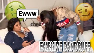 Scratching Dandruff On My Bestfriend Prank