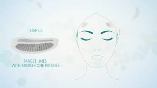 Exuviance Ha100 Micro-Filler Regimen