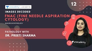 Images Decoded | Ep 12 | FNAC ( Fine Needle Aspiration Cytology)  | Dr. Preeti Sharma screenshot 3