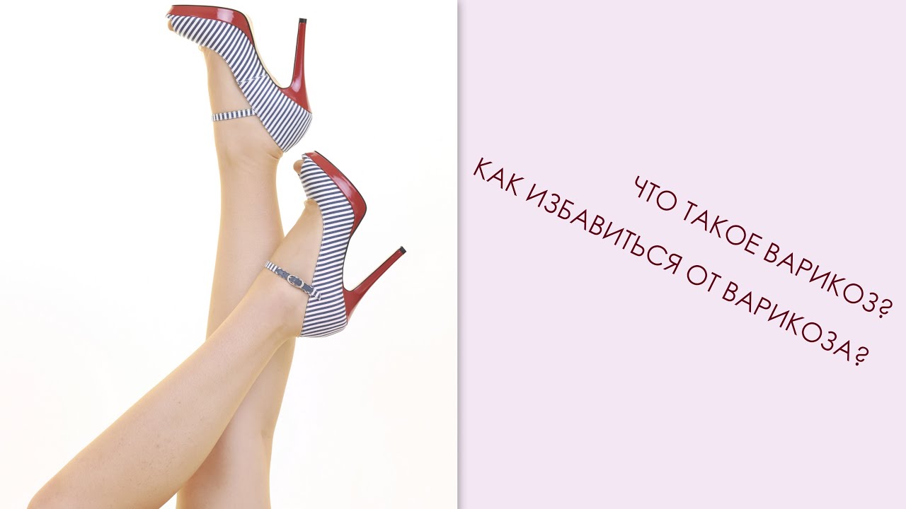 ЛФК кабинет / Варикозное расширение вен, что это такое и что делать ...