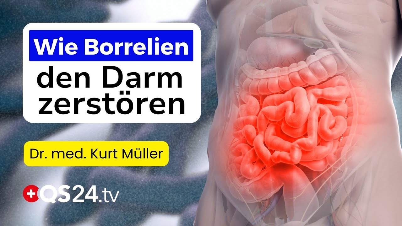 Borreliose – Die unterschätzte Ursache vieler Darmkrankheiten? | Dr. med. Kurt Müller | QS24 Gremium
