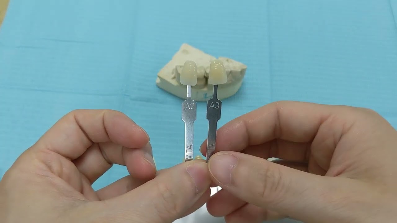 Как выглядит цвет зуба А2