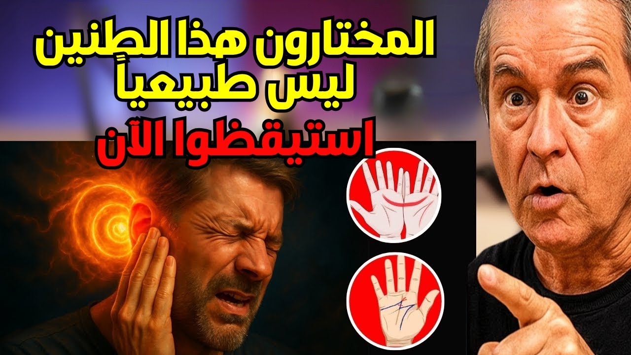 احذر من الطنين في الأذن، أيها المختارون المُعَلَّمون بـ "M" والهلال