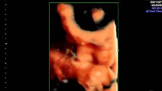 IMG 20130731 1 4 VolCine