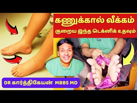 கணுக்கால் வீக்கம் குறைய 5 பயிற்சிகள் | 5 leg swelling treatment exercises demo