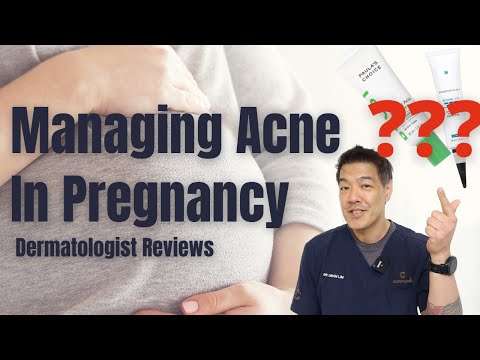 Managing Acne in