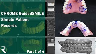 CHROME GuidedSMILE: Simple Patient Records Webinar (Part 3 of 4)