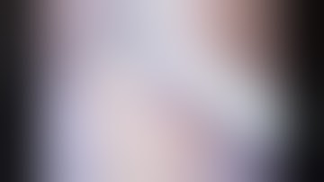 Lap total gastrectomy distal pancreatectomy splenectomy & anterior resection - Jaideep Raj Rao