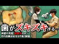 【 歯がズキズキする 】歯の神経の炎症！歯髄炎の治療法とは？　#歯髄炎　#歯医者　#根管　#根幹
