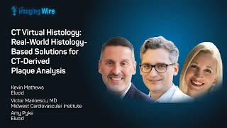 The Imaging Wire Webinar -- CT Virtual Histology:  Real-World Solutions for CT Plaque Analysis